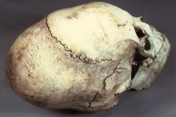 Extraterrestrial skull